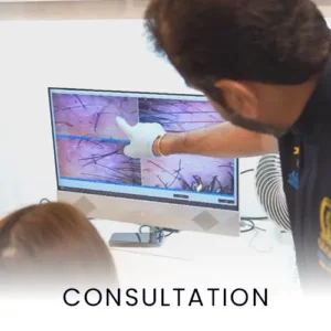 consultation-hair-surgery-procedure-300x300