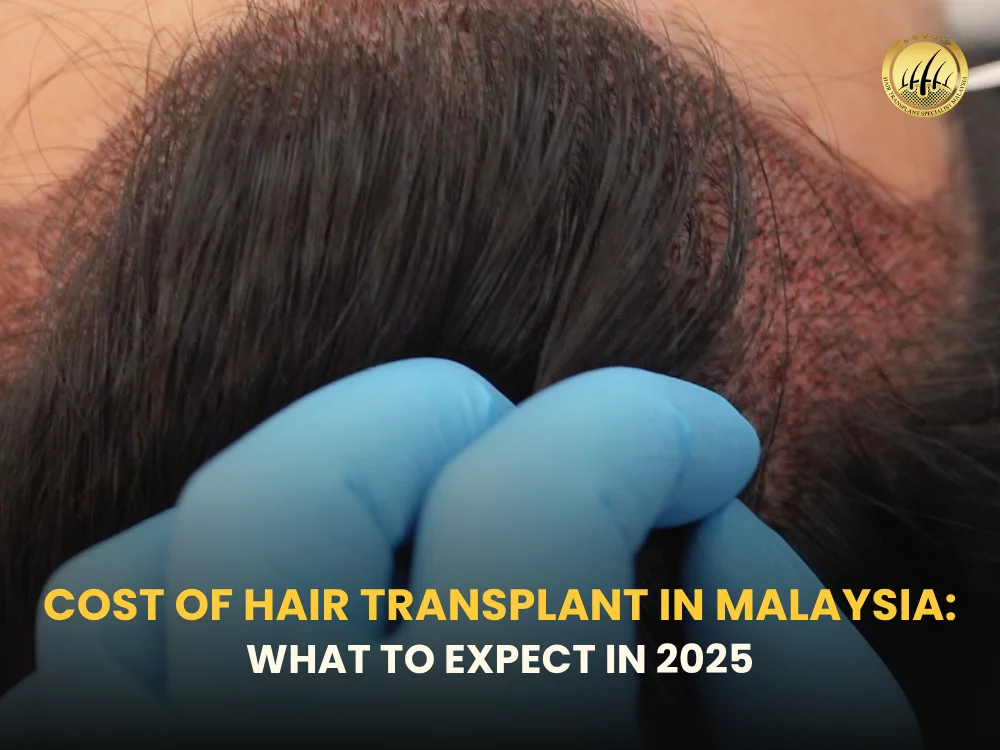cost-of-hair-transplant