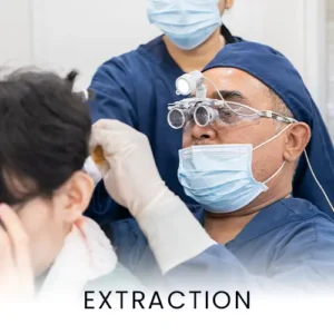 extraction-hair-surgery-procedure-300x300