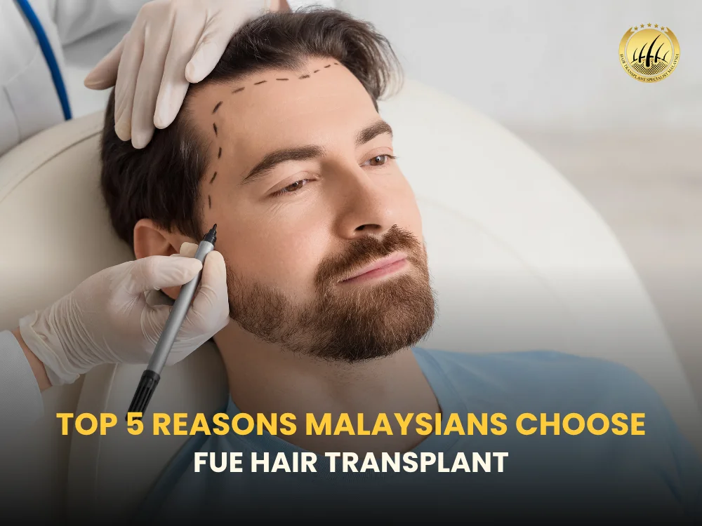 fue-hair-transplant