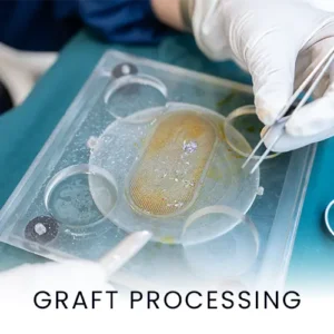 graft-processing-hair-surgery-procedure-300x300
