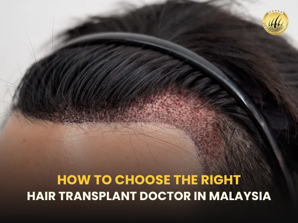 right-hair-transplant-doctor
