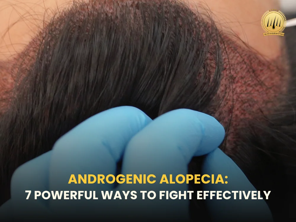 androgenic-alopecia