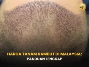 harga-tanam-rambut