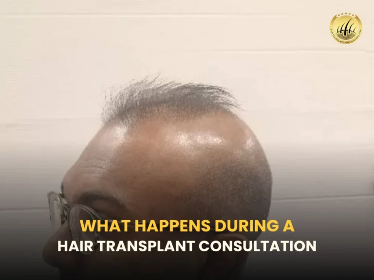 hair-transplant-consultation