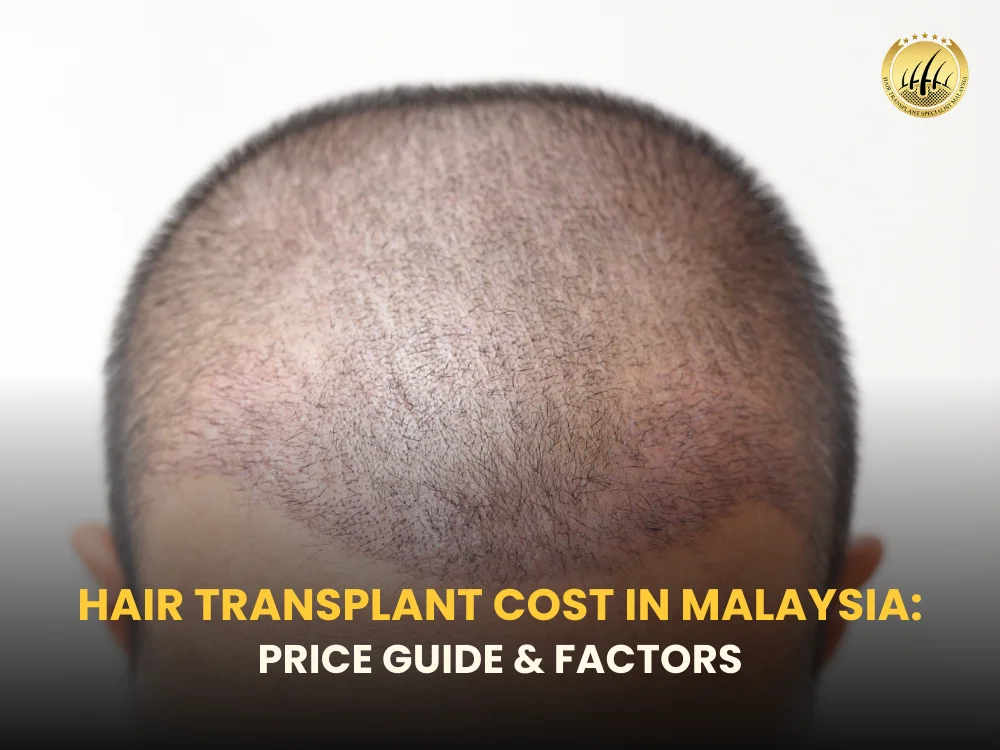 hair-transplant-cost-malaysia