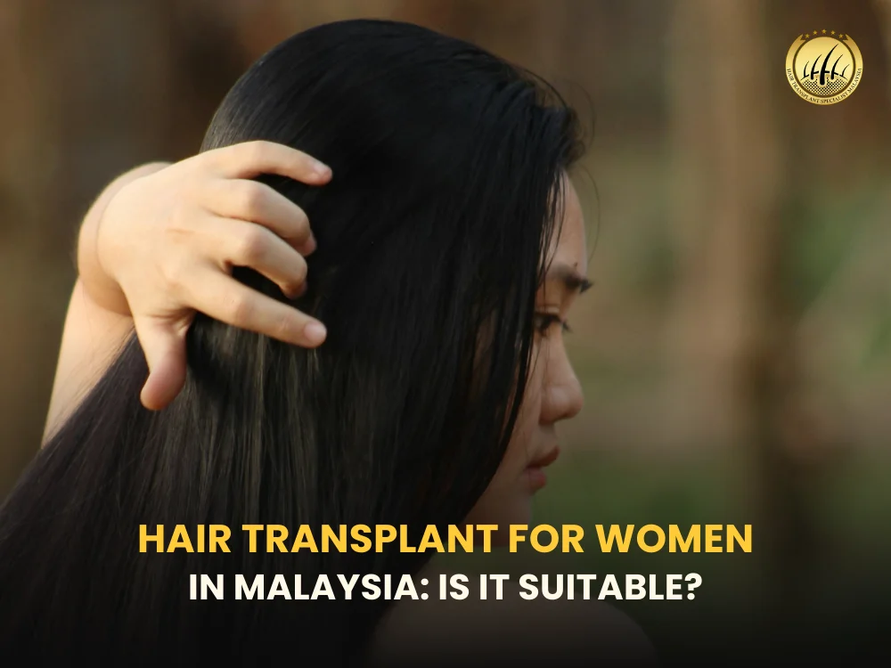 hair-transplant-for-women-malaysia