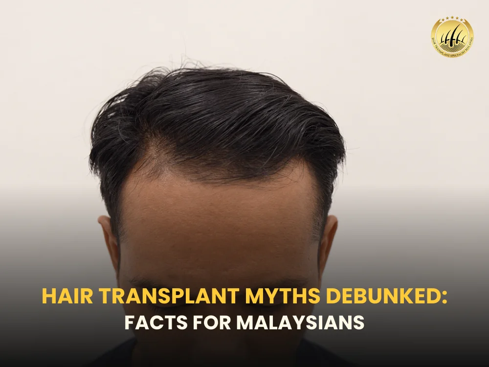 hair-transplant-myths-malaysia