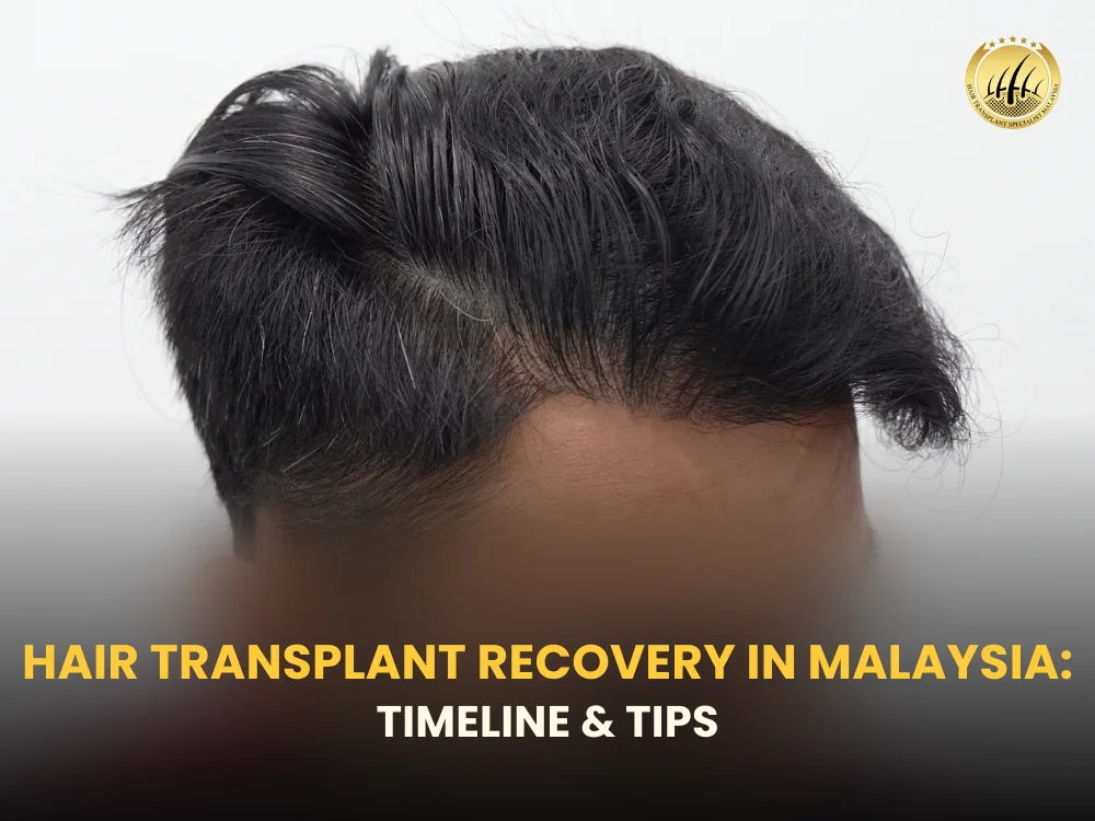 hair-transplant-recovery-malaysia