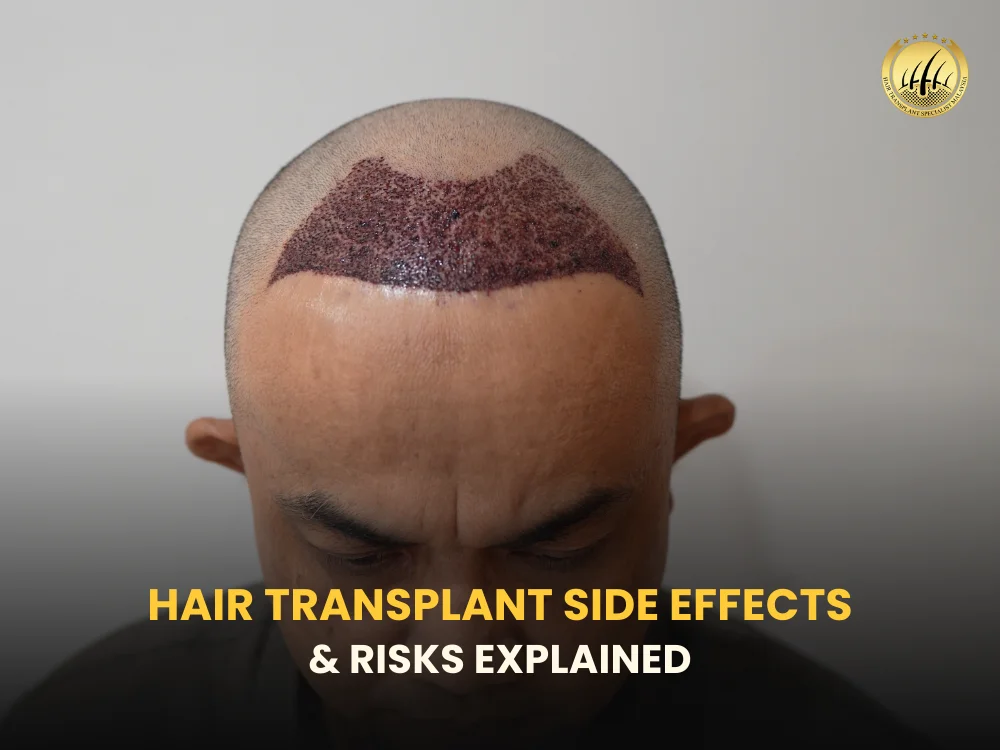 hair-transplant-side-effects-malaysia