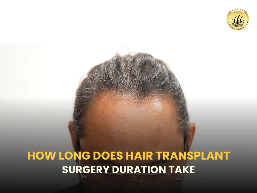 hair-transplant-surgery-duration