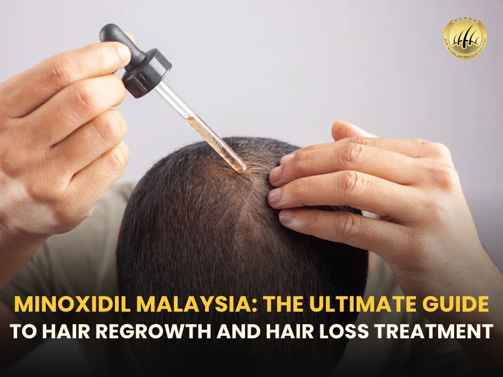 minoxidil-malaysia