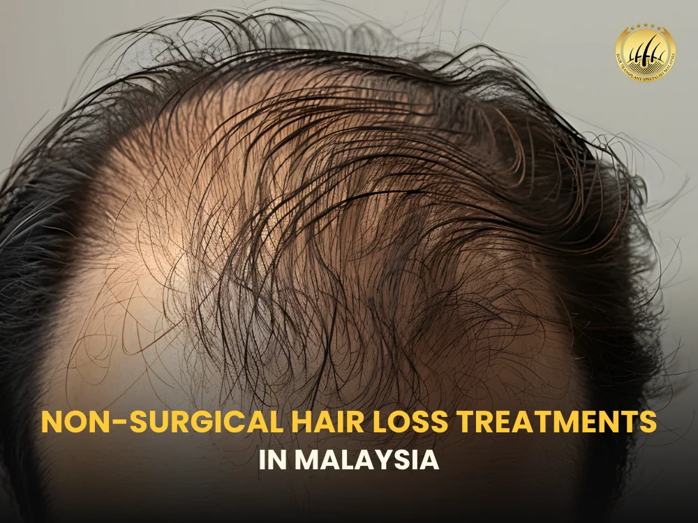 non-surgical-hair-loss-treatments-malaysia