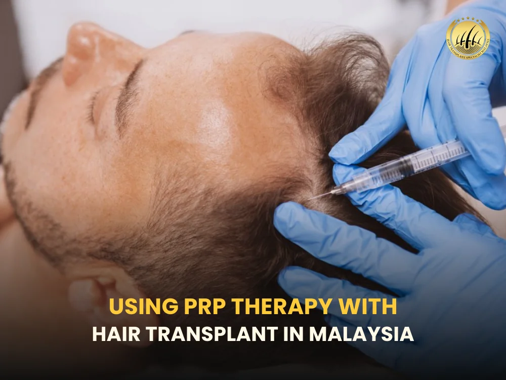 prp-for-hair-transplant-malaysia