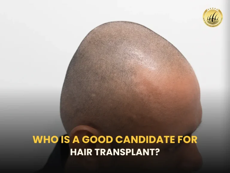 hair-transplant-candidate
