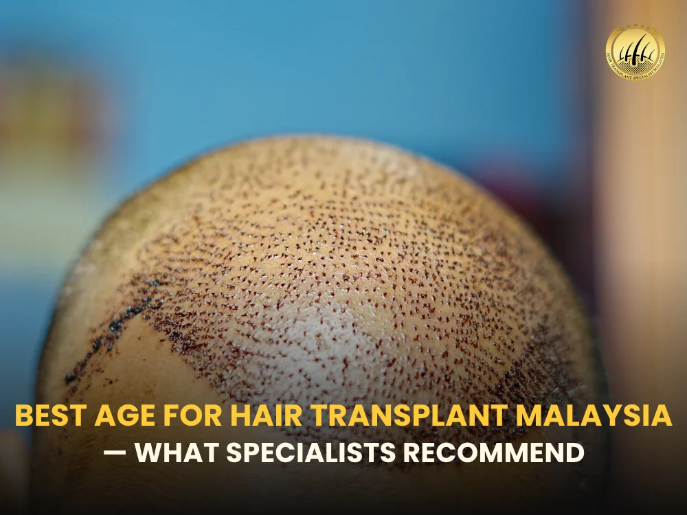 best-age-hair-transplant-malaysia