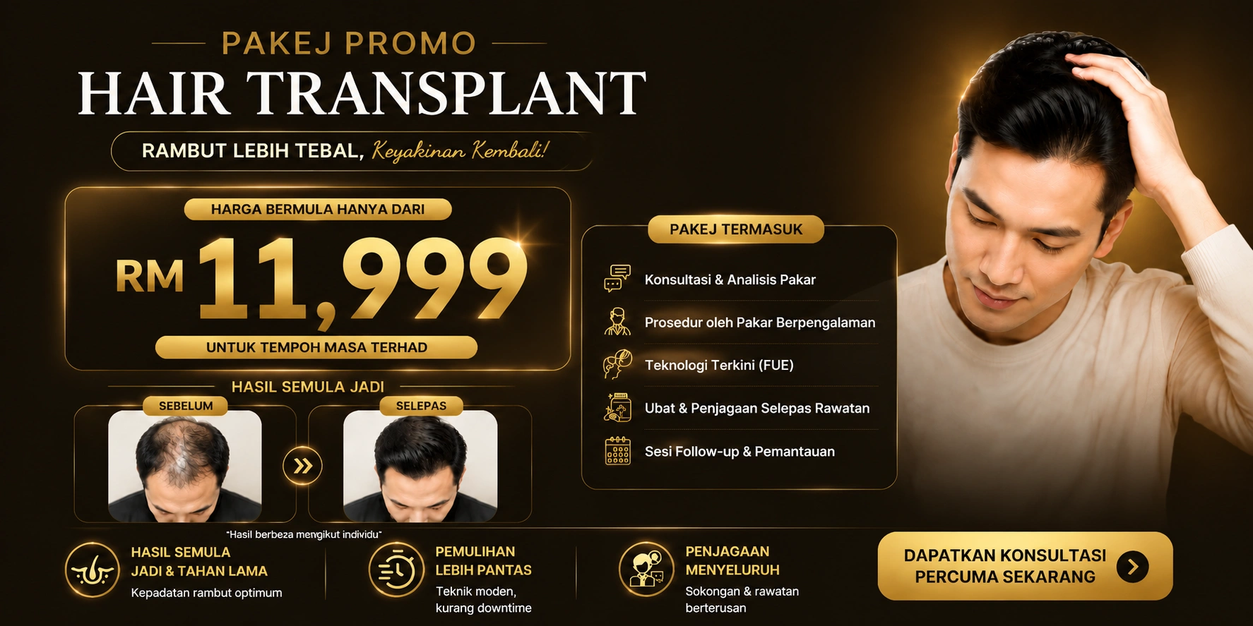 Hair Transplant Malaysia Promotion