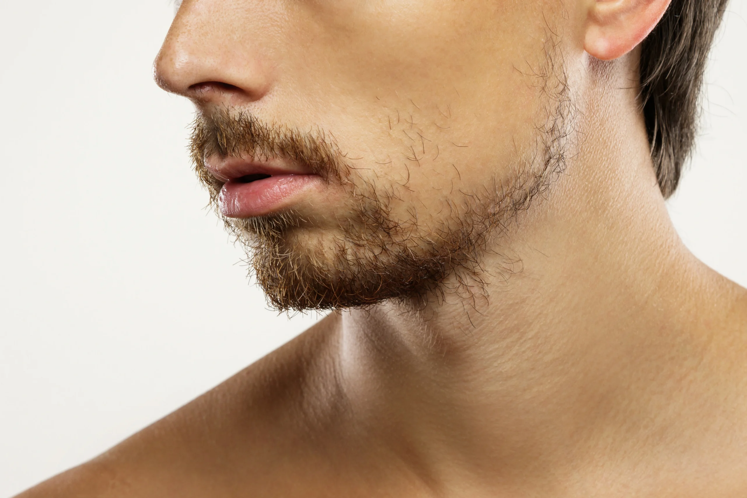 Uneven beard or eyebrow growth