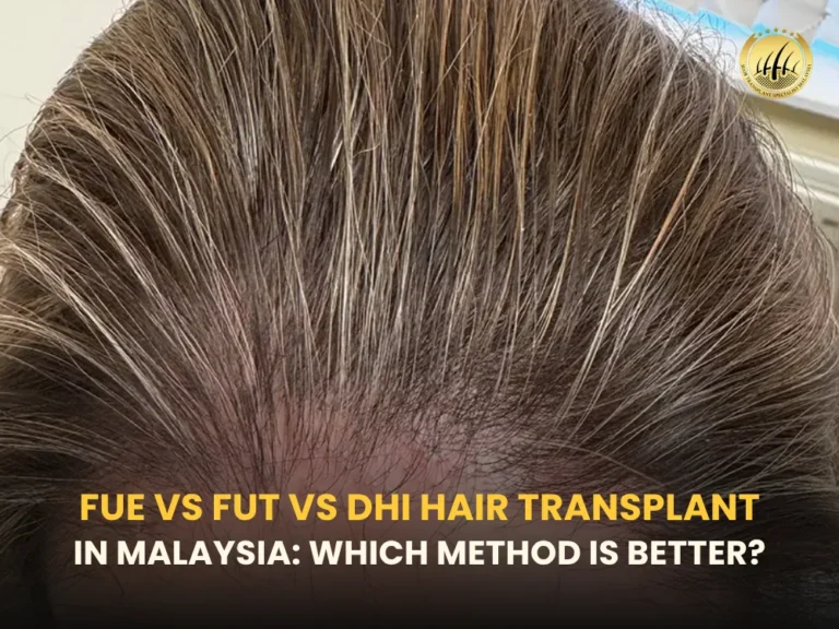 fue-vs-fut-vs-dhi-hair-transplant
