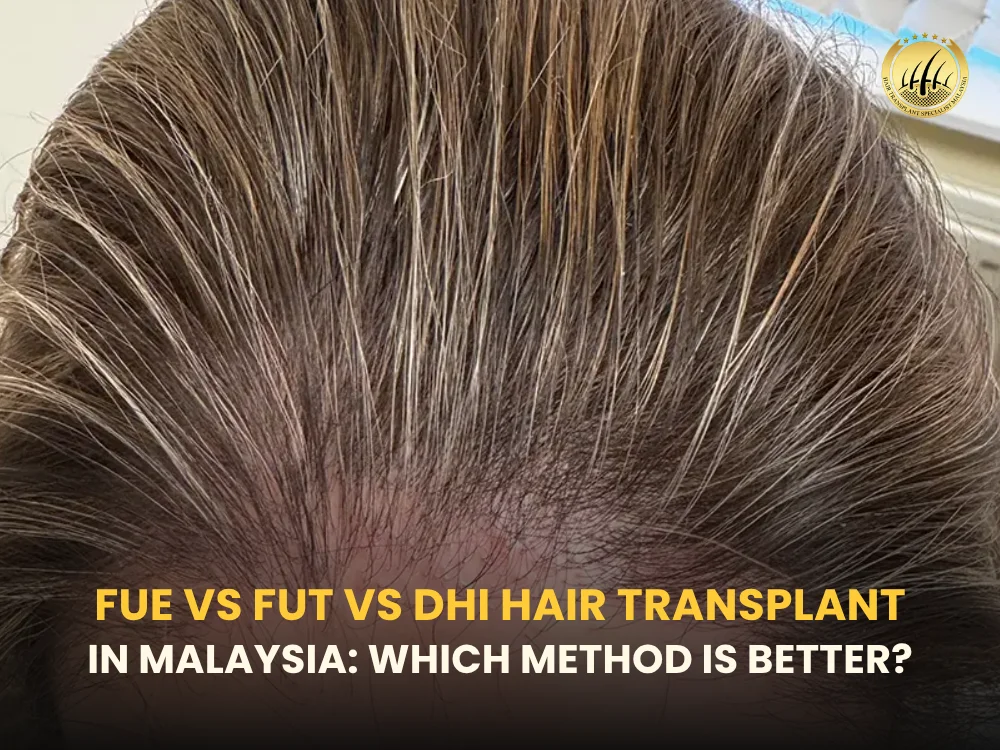 fue-vs-fut-vs-dhi-hair-transplant