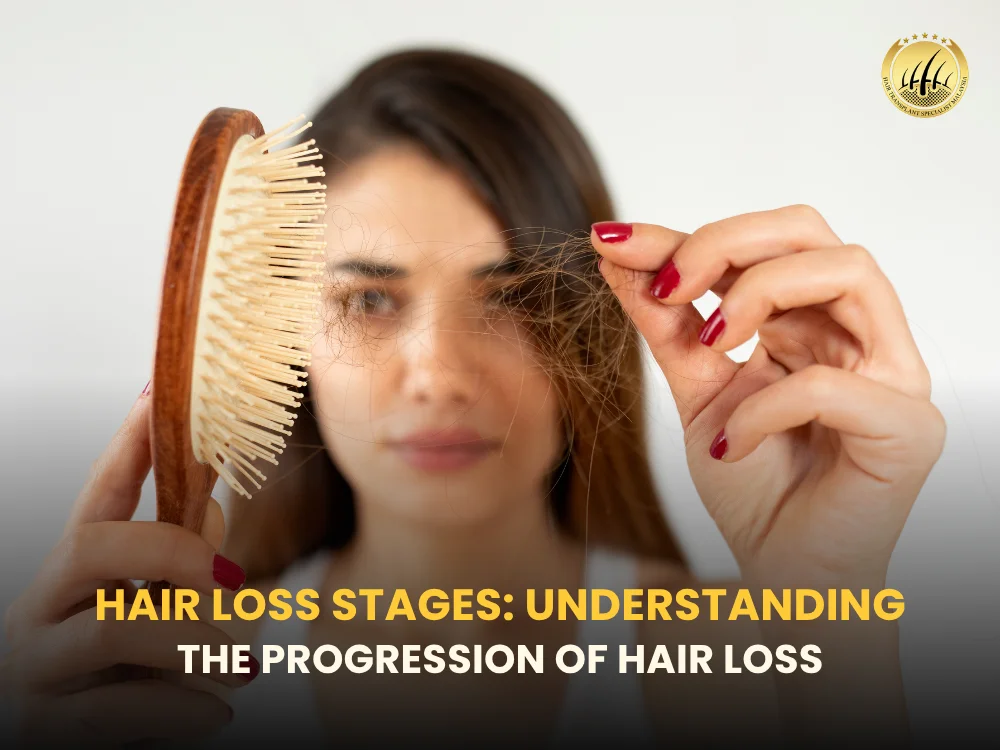 hair-loss-stages